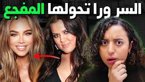 اختفاء "بوني هيم" في ظروف غامضة