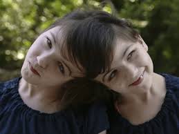 Kembar seiras ni, bercantum di kepala, boleh dengar fikiran masing-masing  dan nampak melalui mata masing-masing. Apa pendapat korang pasal kesedaran?  : r/consciousness