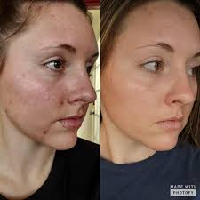 LOS ANGELES — A judge