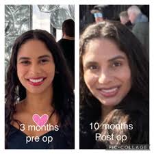 Functional issues not addressed, more problems & look like a...