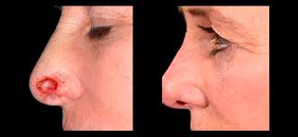 Reconstructive and paediatric gallery