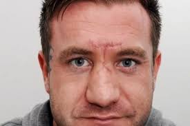 Cyclist abused as he lay bleeding in road