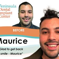 TOP 10 BEST Dental Lab near San Carlos, CA