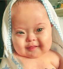 Un cromosoma extra de puro amor en este hermoso bebé. 🥰