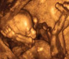 You Are 17 Weeks And 6 Days Pregnant Familyeducation