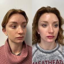 Brooke Carrero RN, BSN