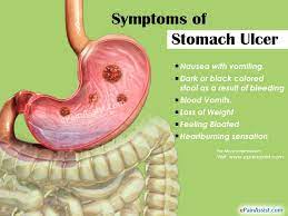 Stomach Ulcer Or Peptic Ulcer Disease|Treatment|Home  Remedies|Epidemiology|Causes|Symptoms|Prognosis