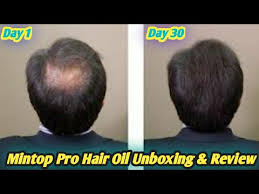 Dr reddys mintop pro procapil hair therapy, 75ml. Mintop Pro Hair Regrowth Results Minoxidil Hair Regrowth Unboxing Review Healthy Lifestyle Youtube