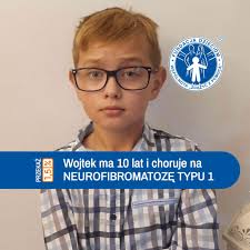 Licytacje dla Wojtusia Kiełbasy