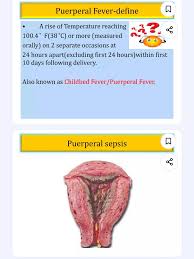 Image result for Postpartum Fever