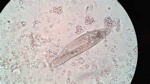The cell body is roughly Amoeba Under Microscope 40x Shefalitayal
