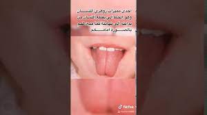 Check spelling or type a new query. Ø§Ù„Ø§Ù†Ø³Ø§Ù† Ø§Ù„Ø²ÙˆÙ‡Ø±ÙŠ Ø²ÙˆÙ‡Ø±ÙŠ Ø§Ù„Ø³Ø§Ù† ÙˆÙ…Ù…ÙŠØ²Ø§ØªÙ‡ Youtube