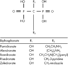 Image result for Bisphosphonates