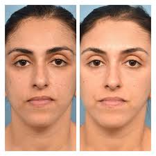 Destin Bell (@skinandbrows904) • Instagram photos and videos