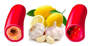 L'aillicine de l'ail et ses différents composés soufrés facilitent l'ail donne une meilleure élasticité à l'aorte (la grosse artère qui sort du coeur et irrigue tout l'ail a prouvé ses qualités en matière de santé, il permet de fluidifier le sang, de combattre les infections. Les Bienfaits Du Citron L Ail Et Le Gingembre Sur La Sante