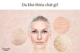 Da Khô Thiếu Chất Gì? Cách Chăm Sóc Da Khô Tại Nhà Hiệu Quả