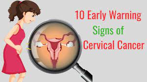 Check spelling or type a new query. 10 Early Warning Signs Of Cervical Cancer You Should Not Ignore Youtube