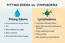 Image result for Edema Exam