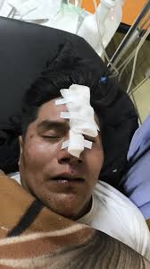 🚨)) AVISO A LA COMUNIDAD Hacemos el llamado de suma urgencia a los  familiares o conocidos del joven EUSEBIO OROZCO MAMANI de 39 años de edad,  que ingreso al servicio de emergencia