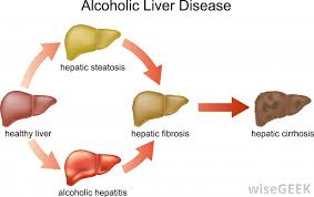 The location of the liver. Hepatic Encephalopathy Meaning In Hindi Traduire De