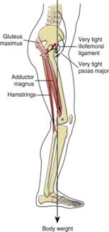 Maybe you would like to learn more about one of these? Principles Of Biomechanics In Hip Flexion Contracture Physiopedia