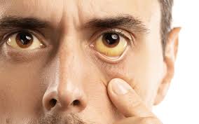 Gastroenterologist in Lilburn GA