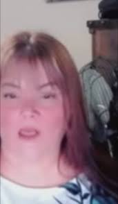 Is there a bruise above Sunny's right eye?