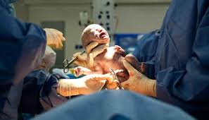 Gatal pada bekas jahitan pada umumnya merupakan hal yang wajar sebagai bagian dari proses regenerasi jaringan yang sebelumnya mengalami luka. 5 Cara Merawat Bekas Jahitan Operasi Caesar Agar Cegah Infeksi Cantik Tempo Co