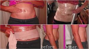 Pin On Weight Loss
