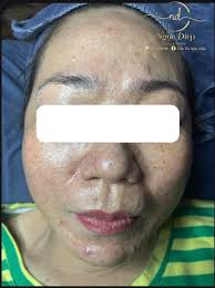 Spa Ngọc Diệp Thạnh Phú Bến Tre