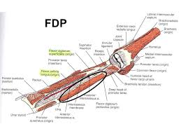 Zone 1 is distal to the flexor digitorum superficialis insertion (fds) and contains only the flexor digitorum profundus (fdp), zone 2 contains both the. Flexor Tendon Injuries Of The Hand Ppt Video Online Download