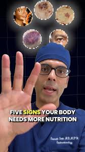 Doctor Sethi : 5 Signs Your Body Needs More Nutrients ‼️🚨