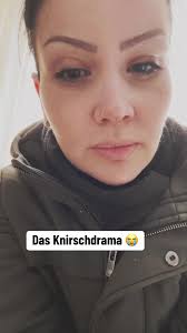 Zahnarzt-Tipps gegen Knirschen: Hilfreiche Ratschläge