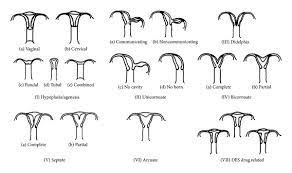 What every clinician should know. Classification Of The Anomalies Of Mullerian Duct Developed By American Download Scientific Diagram
