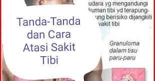 Last updated on november 21, 2017 by tongkrongan islami. Cara Merawat Penyakit Tibi Daripada Berulang