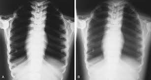 Image Characteristics Radiology Key