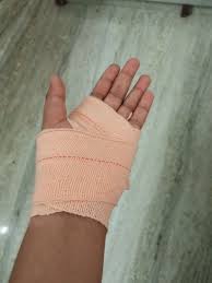 Image result for Hand Fracture