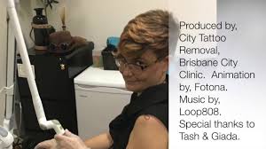 The crc tattoo remover system is even less invasive than tattoo vanish, so we typically recommend this method for clients with more delicate skin. How To Find City Tattoo Removal From City Hall Youtube