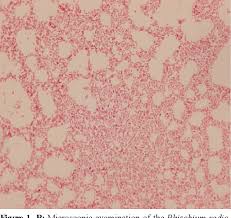 Image result for Rhizobium radiobacter, syn. Agrobacterium tumefaciens