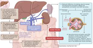 Image result for Postrenal Failure