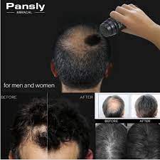 While getting a good hair color for hair that is thinning can be a tough adventure, products such as powders and sprays can easily give a safe alternative to heavy hair dyes. Pansly Hair Building Fibers Keratin Hair Powder Thinning Hair Loss Concealer Alexnld Com