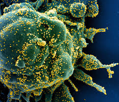 Sepsis is a serious medical condition. Blutvergiftung Erkennen Und Behandeln So Verhalten Sie Sich Bei Einer Sepsis Richtig Gesundheit