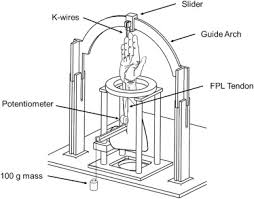 Patellar tendonitis involves small tears in the tendon that connects the kneecap to the shin. Supplemental Materials For Calculation Of Flexor Pollicis Longus Moment Arm For Wrist Motion In A Cadaver Model Validates The Tenodesis Effect For Therapy Journal Of Hand Therapy