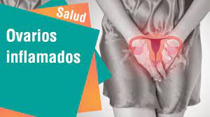 Que Provoca Tener Ovarios Inflamados Salud Youtube