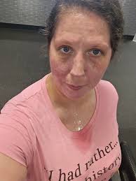 Recovery and gratitude in fitness journey