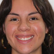 Dr. Cristian F. Palacios Peña (@dr.cristianp_periodoncia) · Instagram 照片和视频