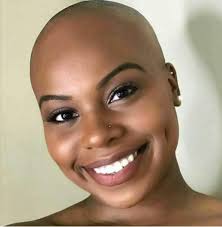 Pin By Byates On Bald Girls Bald Girl Hair Growing Vitamins Bald Women