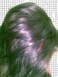 خلطة بلسم اسويها وابيعها لشعر ناعم وذايب وتقضي على الجفاف لكم هدية با الصور