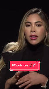 ¿Qué tanto influye tu #pareja en las decisiones que tomas sobre tu #cuerpo?  👀 La falta de #amorpropio, y la influencia de su pareja, llevó a Sandra  Castaño a realizarse un #procedimientoestético del ...