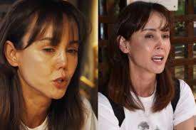 Một nữ diễn viên vỡ nợ hơn 300 triệu, nhan sắc biến dạng vì ngã gãy mũi